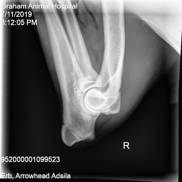 Adsila right elbow elbow a