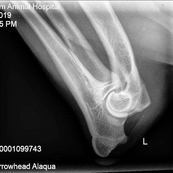 Alaqua left elbow