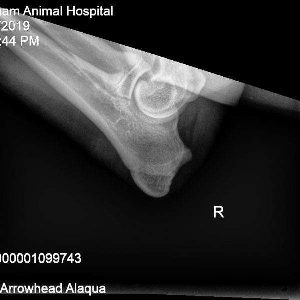 Alaqua right elbow