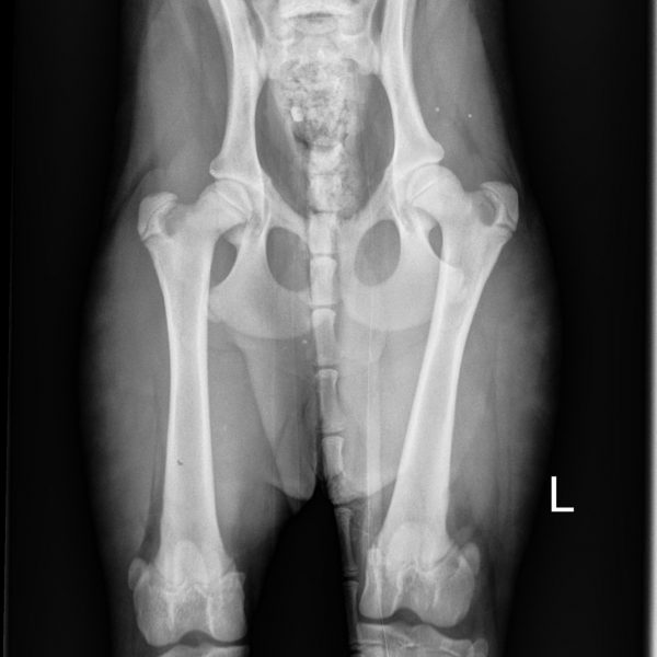 Ayasha pelvis Ayasha pelvis