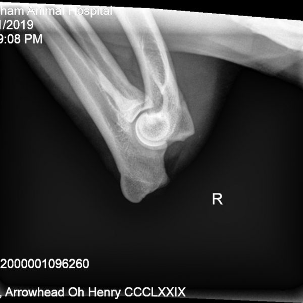 Henry right elbow